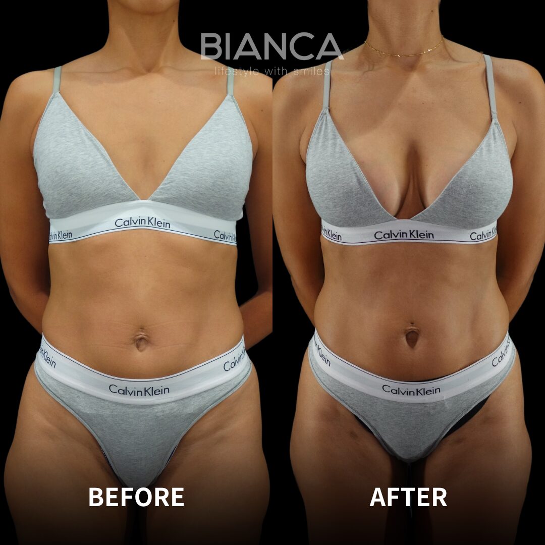 Descriptive Alt Text for Featured Image